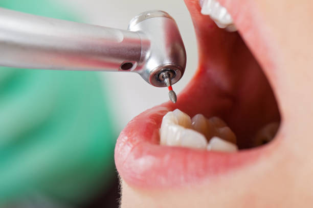 Best Urgent Tooth Repair  in San Rafael, CA